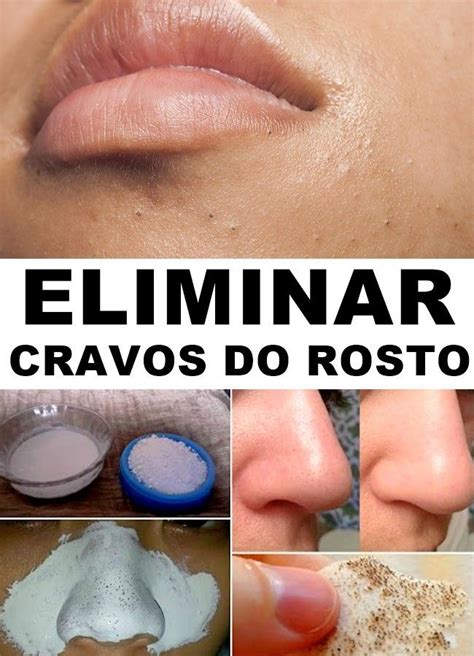 o que da cravo no rosto